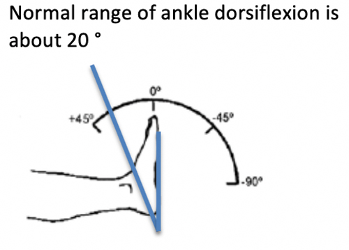 1-3-DMD-ankle-dorsiflexion