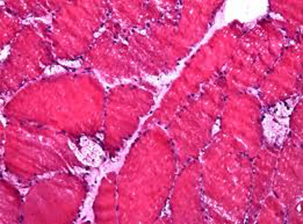 2-3-pompe-vacuoles